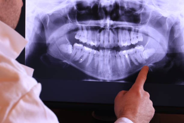 Best Emergency Gum Treatment in Knollwood, IL